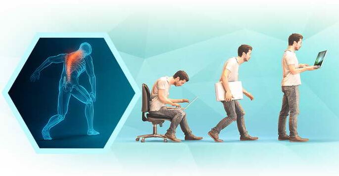 κακή στάση όταν εργάζεστε σε υπολογιστή και θωρακική οστεοχόνδρωση