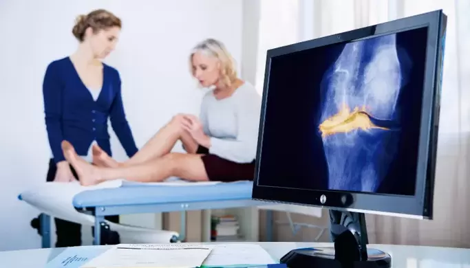 Οστεοαρθρίτιδα της άρθρωσης σε μια γυναίκα